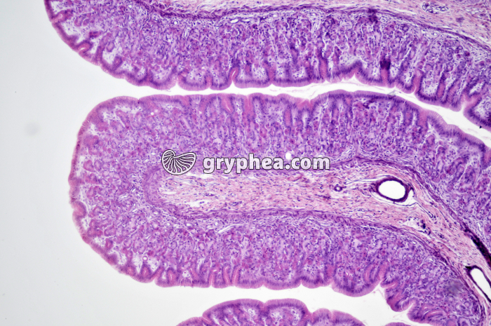 Estomac pylorique x25 - gryphea.org